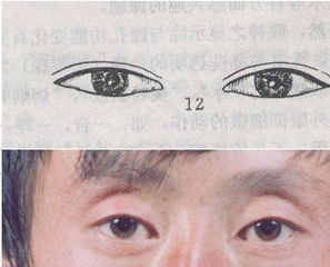 小眼睛吊眼梢单眼皮下八字眉两眼之间距离有点宽(组图)
