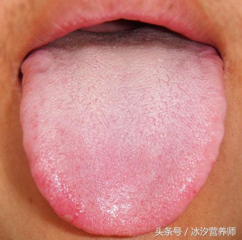 什么样的舌头才能是健康和疾病的预示？