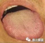 舌尖上的中国：舌头是中医几千年来的经典手法