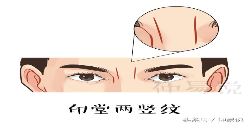 （李向东）男人眉间有竖纹的面相特征有哪些