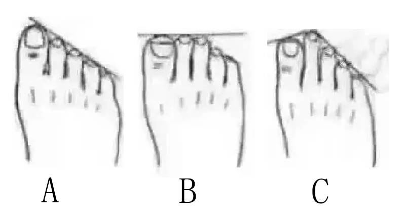 脚相能分析一个人的命运5个脚趾长短看命运图