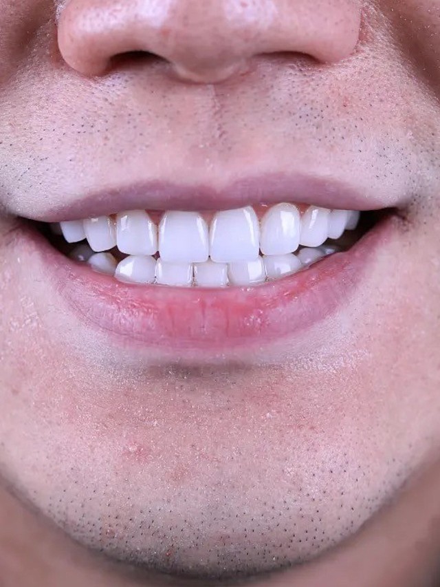 风水堂:男人的十种苦命面相牙齿