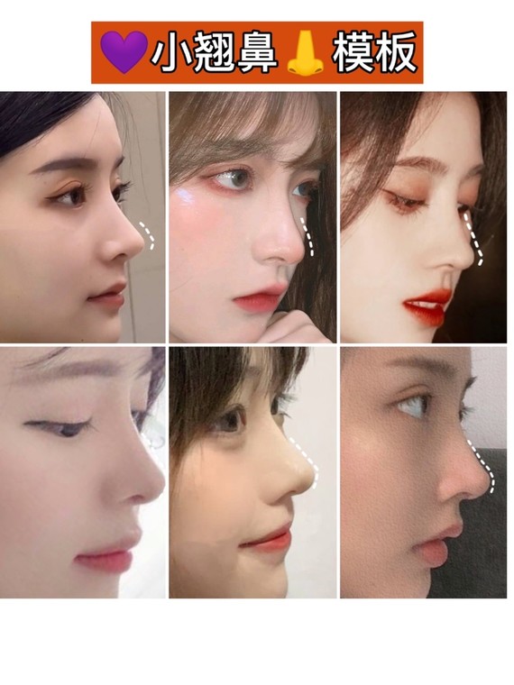 不同脸型的鼻型模板，你适合哪种？