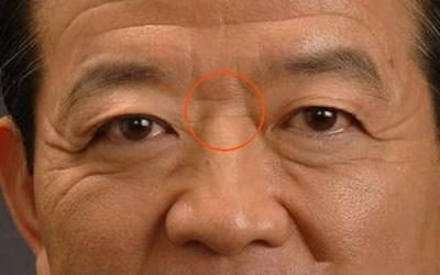 高眉骨和低眉骨有什么区别？